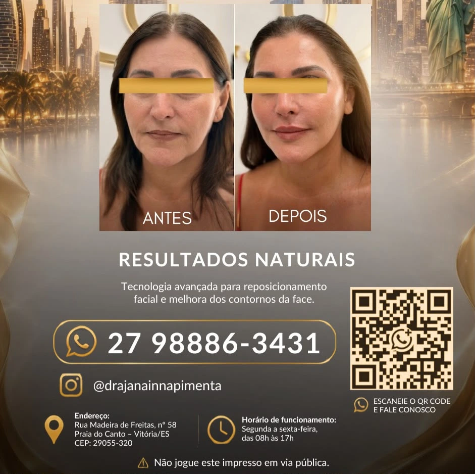Resultados naturais de Antes e Depois do Método Lifting Face Repair