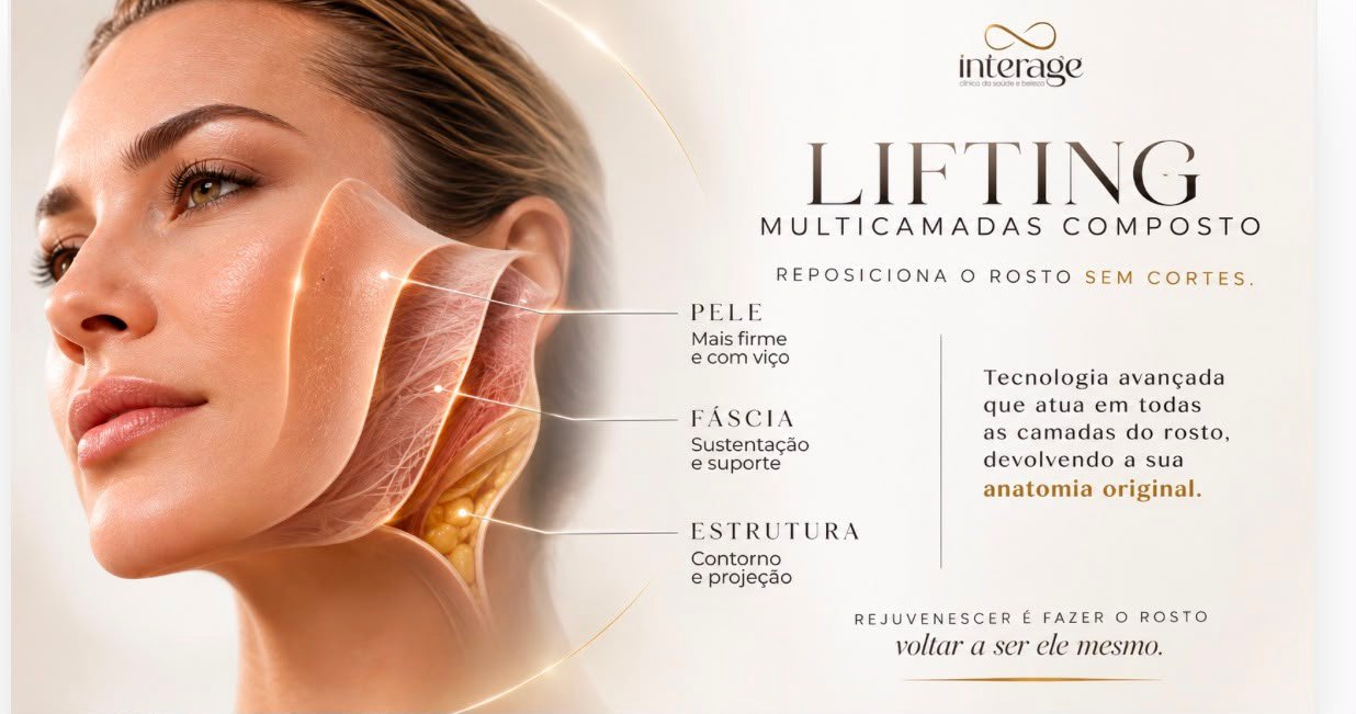 Lifting Multicamadas Composto: a tecnologia que reposiciona o rosto sem cortes